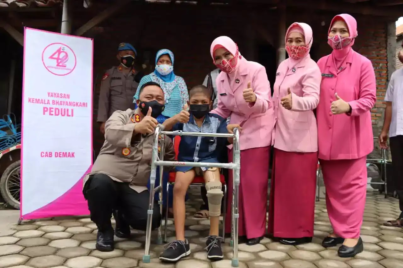 Polres Demak Gelar Bhakti sosial, Kapolres Beri Kaki Palsu Kepada Kiki